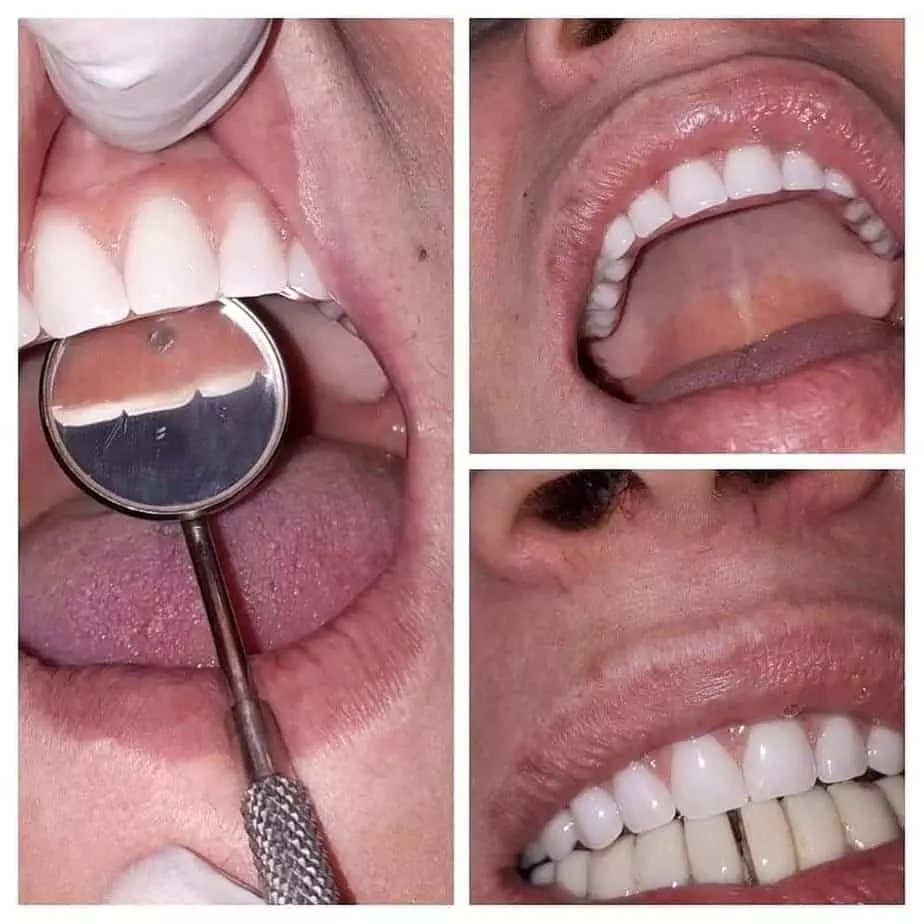 Tratamente dentare doar la AmonraDent • Refu Blog